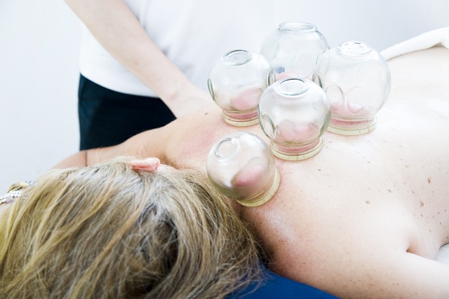 cupping-therapy-6604217_640.jpg